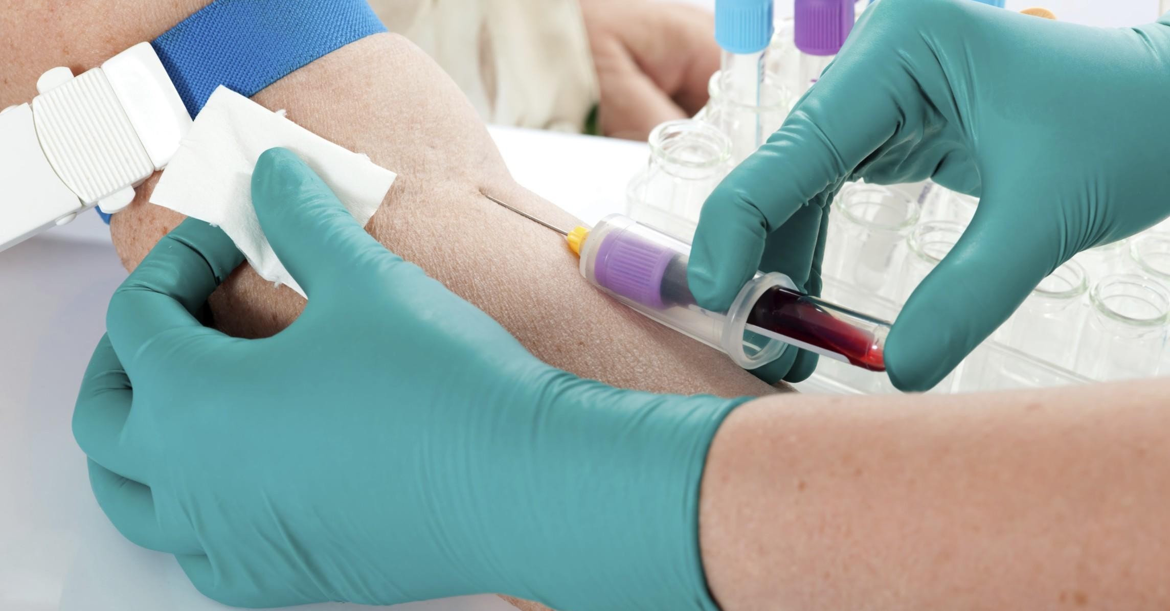 Analisi del sangue a domicilio