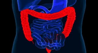 colonscopia robotica