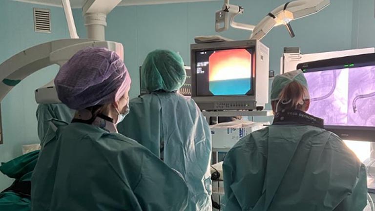 Tumore del dotto pancreatico rimosso per via endoscopica