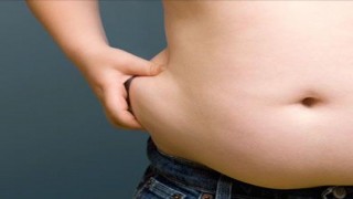 obesità