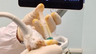 cure artrosi e altro