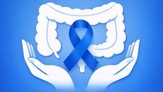 prevenzione tumori al colon retto