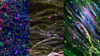 Danno neurlogico- la risposta è differente tra maschi e femmine