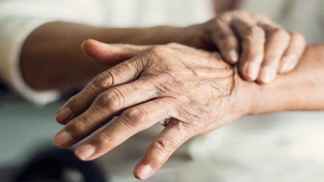 Parkinson