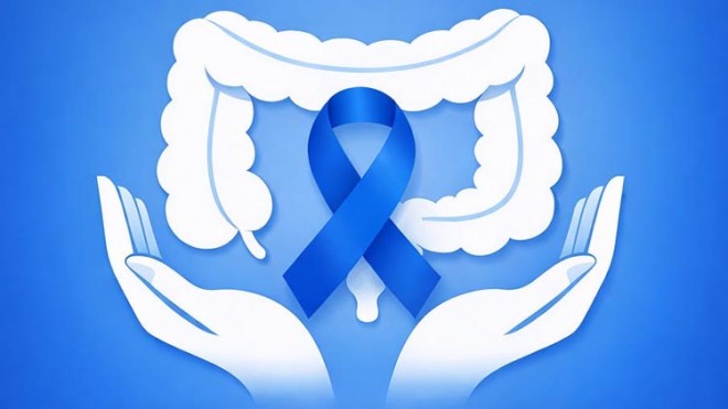 prevenzione tumori al colon retto